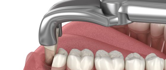 iStock 1440239943 scaled