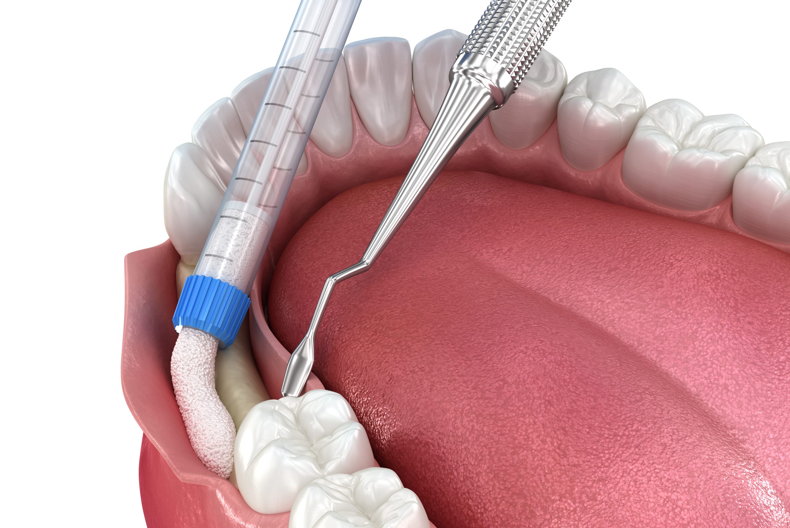 iStock 1469958435 scaled